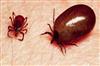 Khabar East:11-Year-Old-Boy-Dies-Of-Suspected-Scrub-Typhus-In-Anugola