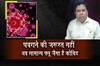 Khabar East:No-Need-To-Panic-COVID-Is-Like-Common-Influenza-Public-Health-Director