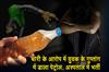 Khabar East:Petrol-poured-into-the-private-parts-of-a-youth-accused-of-theft-admitted-to-hospita